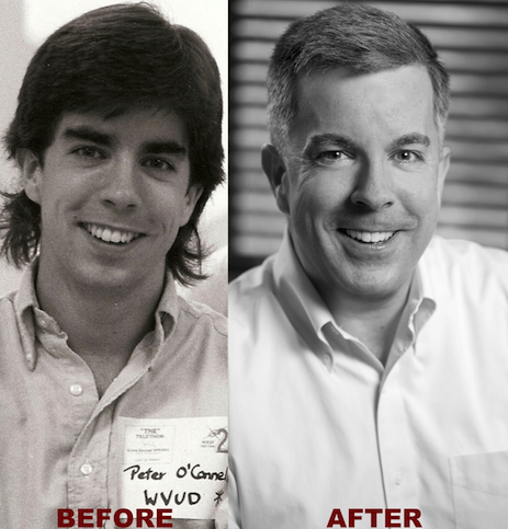 Peter Before_After 35